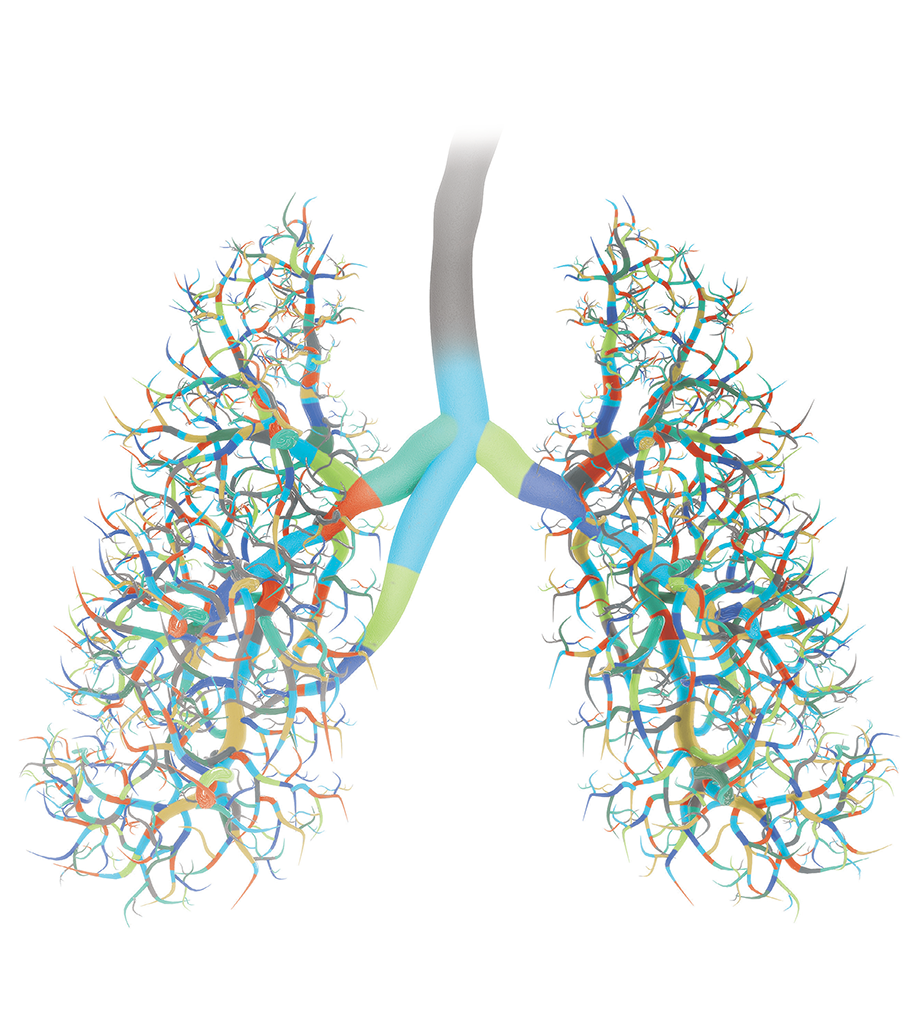 Divide and Conquer - Image of lungs with branches representing the genetic variations only recently found in different patients with small cell lung cancer