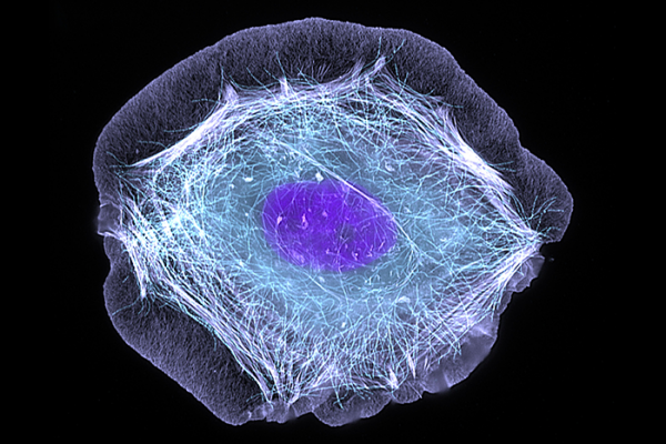 human skin cell treated with a growth factor that enabled the cell to move