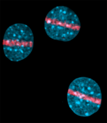 H2AX as a Sensor of DNA Damage