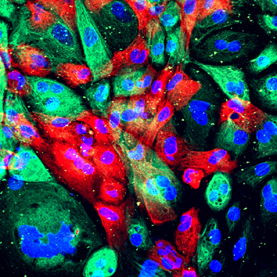 wild-type human prostate cells from an organoid