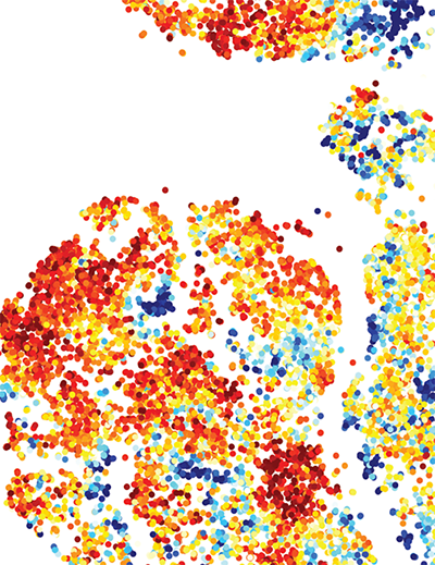 Predicting Melanoma