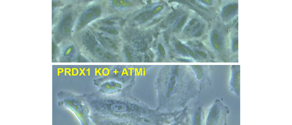 non-small lung cancer cells