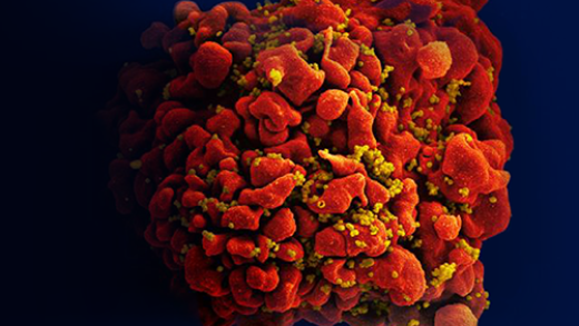 HIV (yellow) buds from an infected immune cell