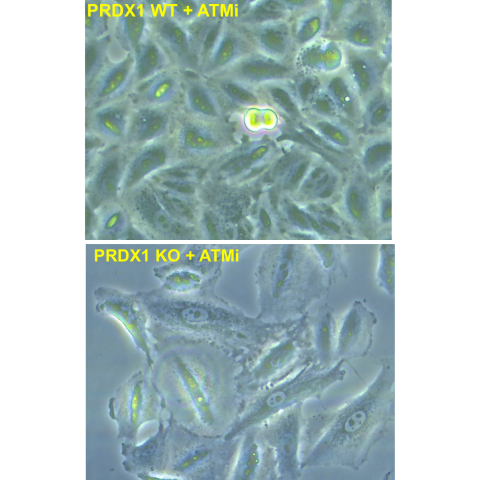 non-small lung cancer cells