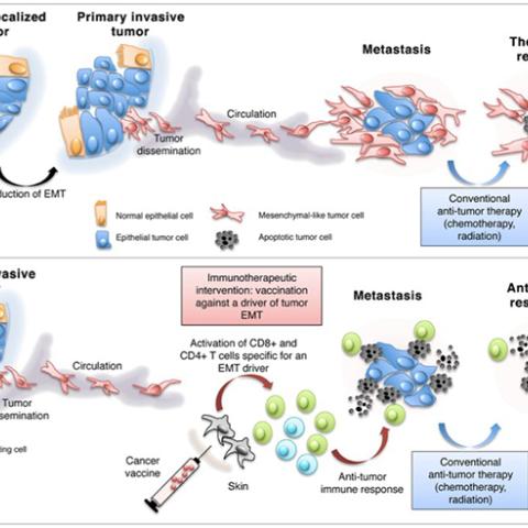 Targeting the epithelial-to-mesenchymal transition