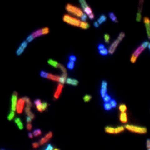 Brain cancer chromosomes