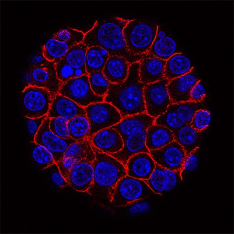 Pancreatic cancer cells