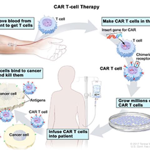 CAR T-cell therapy