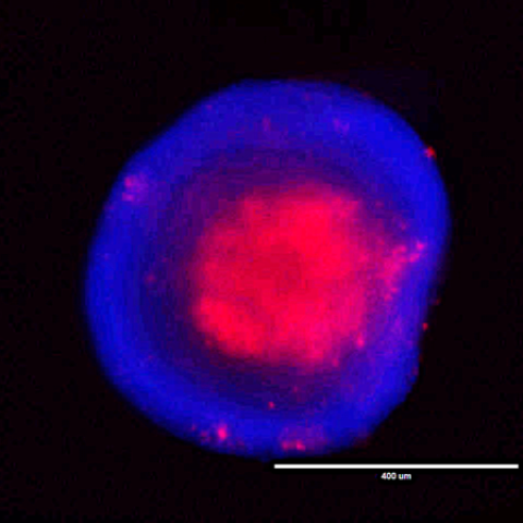 HCT116 (KRAS-mutant) colorectal cancer cell spheroid.