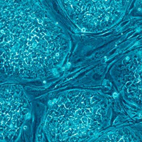 Human embryonic stem cells