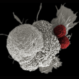 Cytotoxic T cells (red) are shown attacking a squamous cancer cell (white).