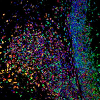 scaffold assisted vaccine