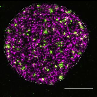 DNA breakage and synthesis in the cell nucleus