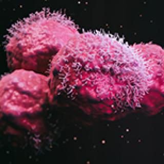 Tumor cells