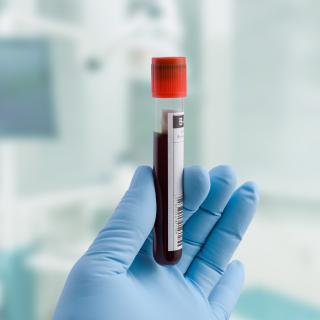 Blood sample