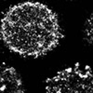 B cells imaged using super-resolution microscopy