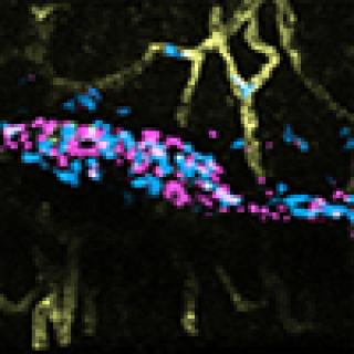 neutrophils