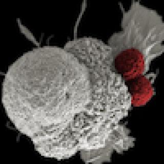 Cancer immunotherapy