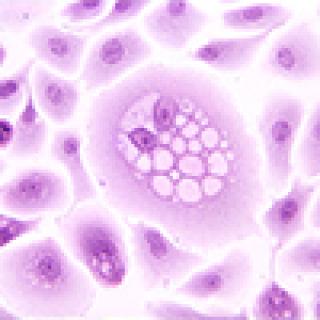 HPV-16 E5 Oncoprotein