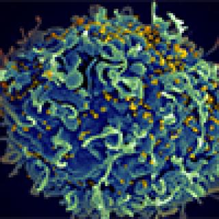 HIV cell