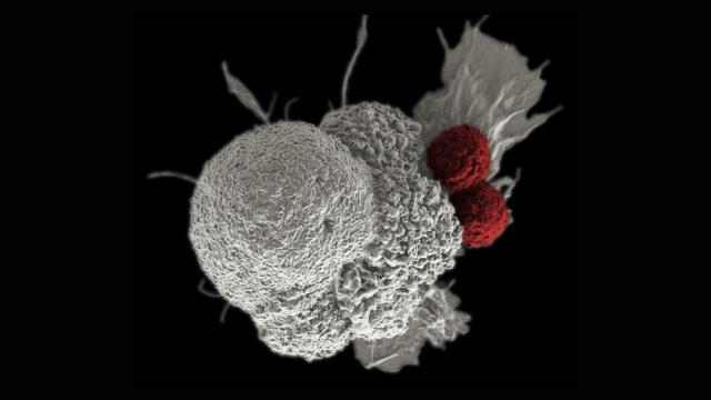 Cytotoxic T cells (red) are shown attacking a squamous cancer cell (white).