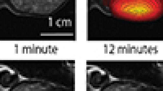 Contour maps created from glucose and lactate signals