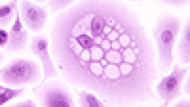 HPV-16 E5 Oncoprotein