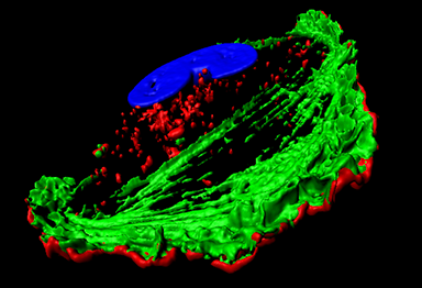 Glioma cell in motion