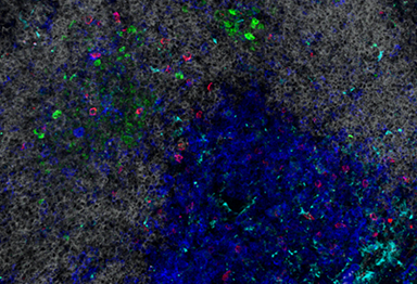 Microscopy image of immune cells in peripheral lymphoid tissue