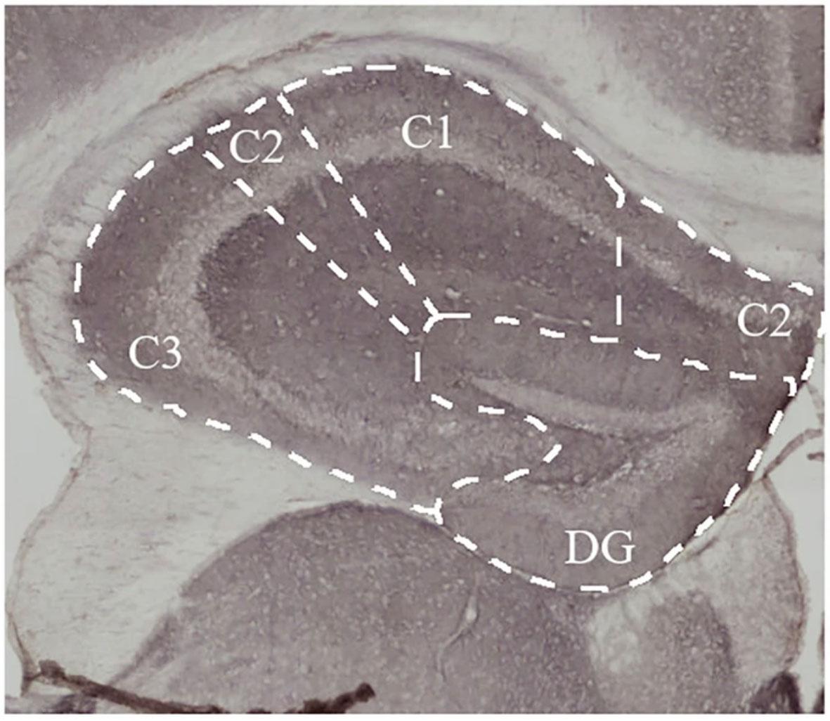 Microscopy image showing a close-up of the hippocamal formation in a mouse brain