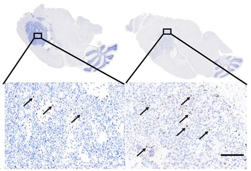 CD8 staining of mouse brain tumor tissue confirming that immune cells called CD8+ T cells are increased in the vaccine group.