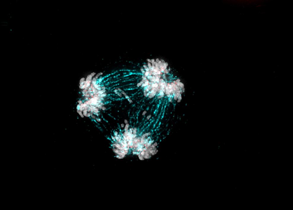 Multipolar spindle metaphase