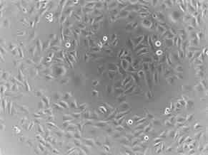 Picture 6 - Rhabdomyosarcoma (muscle tumor) cell line that has not been treated